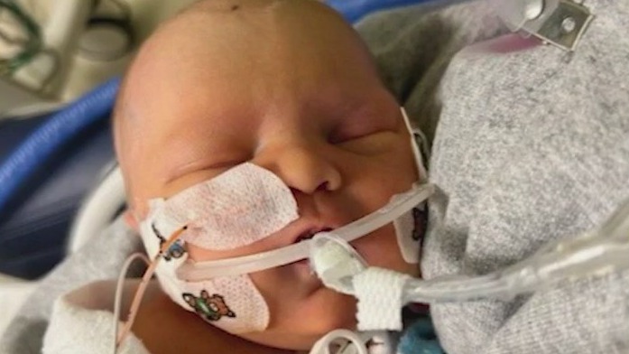 NICU baby thrives after rough life start