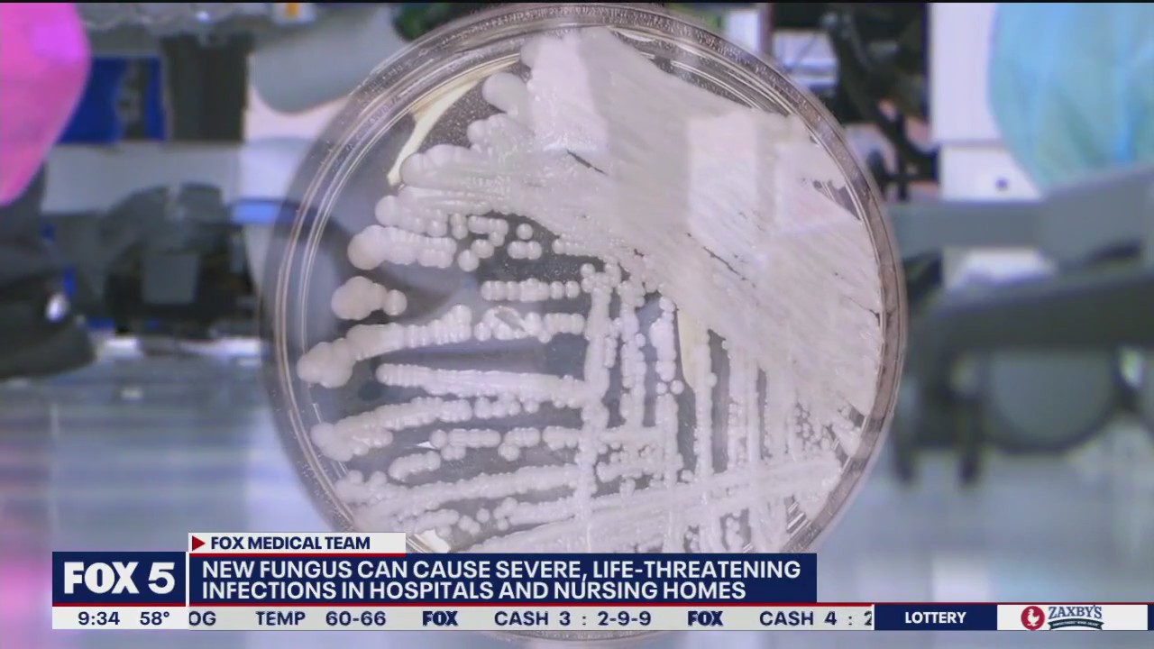 CDC warns emerging fungus can cause severe, deadly infections