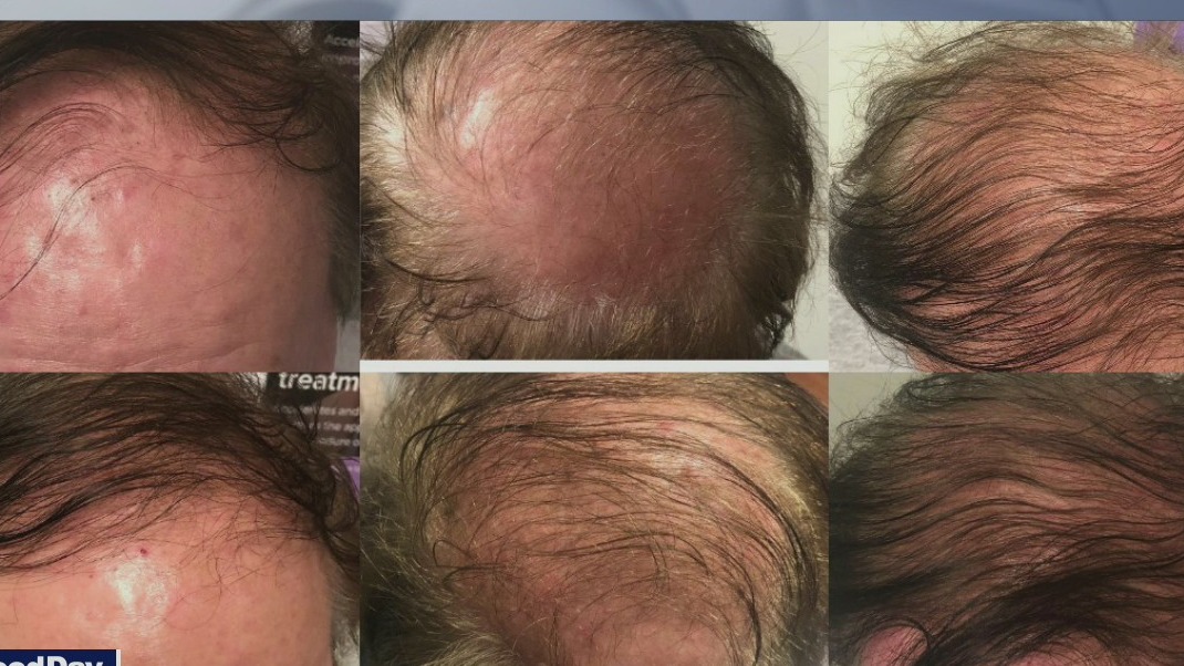 Tweakments to improve your appearance