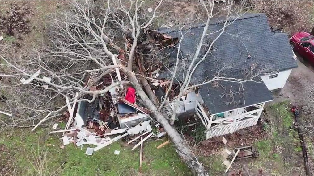 Child's leg broken by falling tree | FOX 5 Atlanta