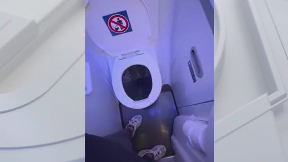 Airplane toilet shocks passenger