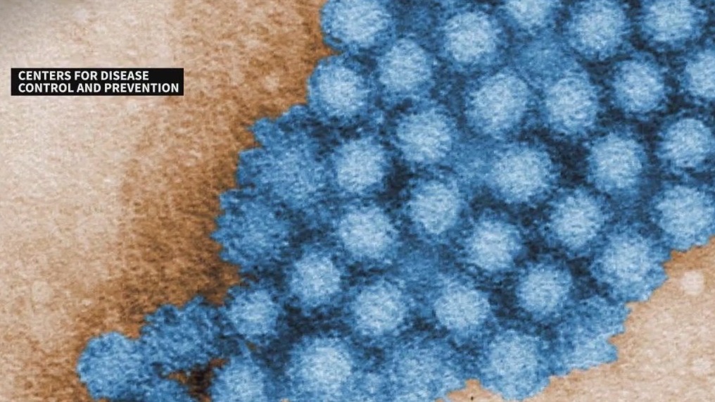 Whooping cough cases on the rise again