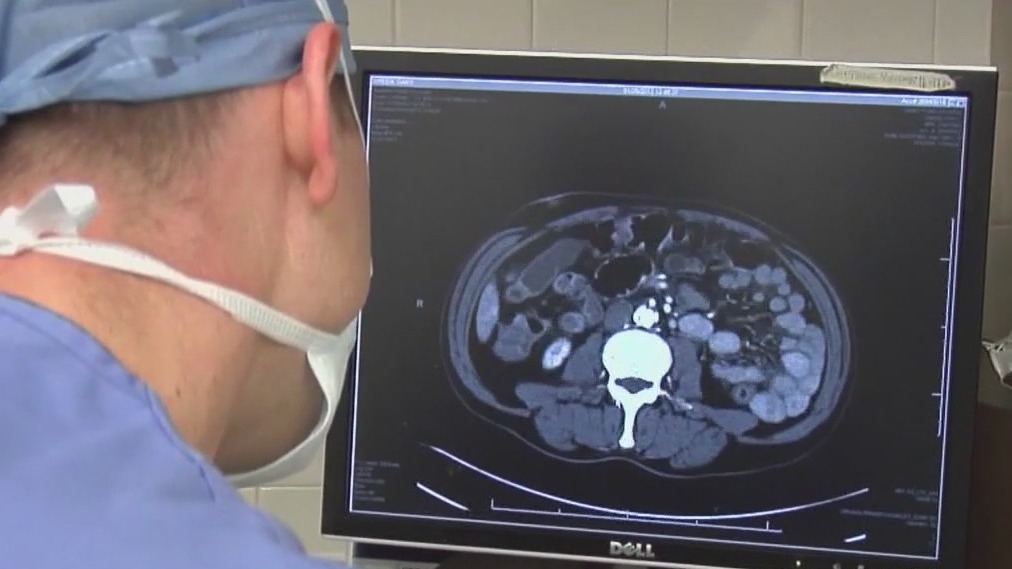 New test can detect prostate cancer from home