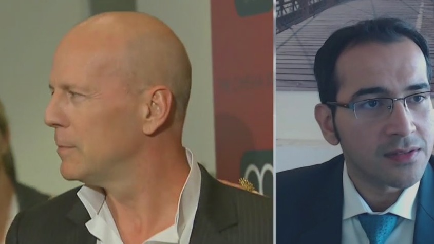 Doctor explains Bruce Willis diagnosis