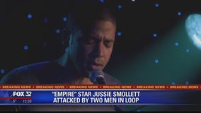 'Empire' star Jussie Smollett hospitalized after possible hate crime in Chicago