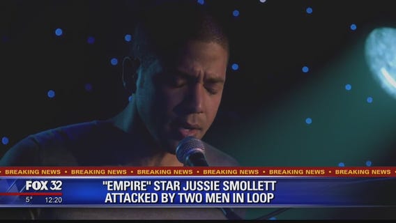 'Empire' star Jussie Smollett hospitalized after possible hate crime in Chicago