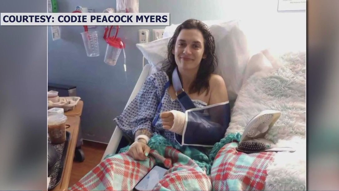 Woman shares her story after surviving attack