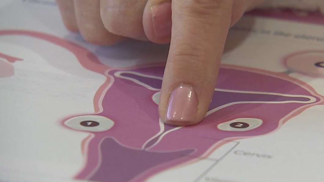 Uterine cancer sees more cases in women