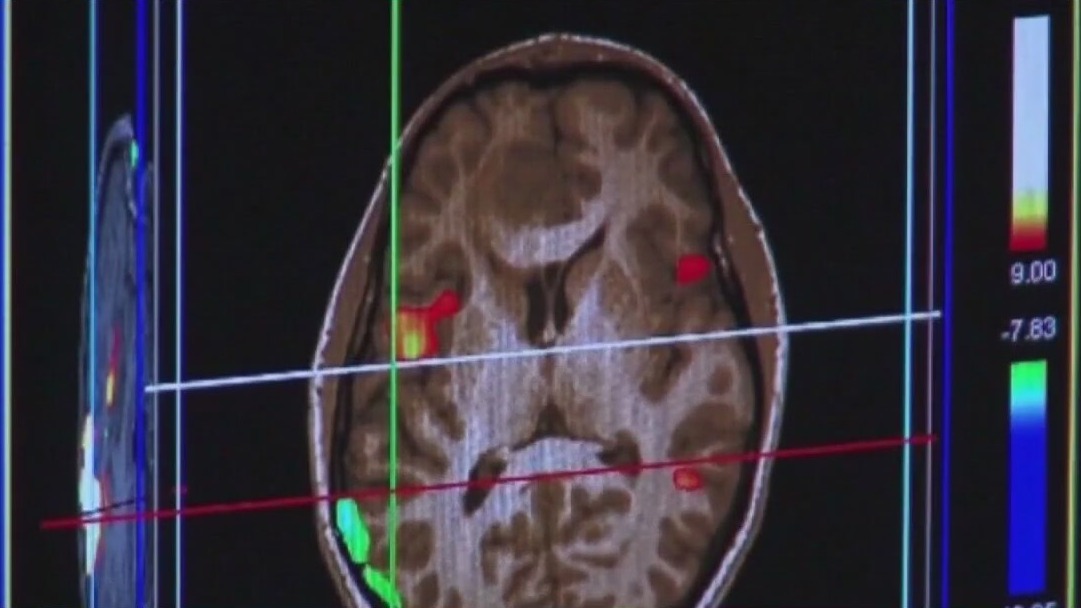 Gov. DeSantis signs bill for dementia training