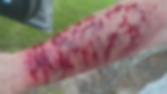 ?Jesus, please help me?: Woman attacked from the sky by snake, hawk