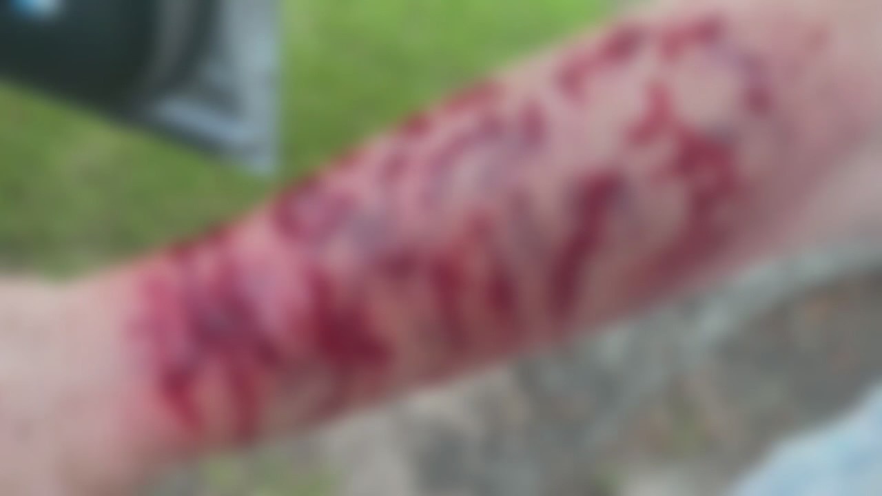 ?Jesus, please help me?: Woman attacked from the sky by snake, hawk