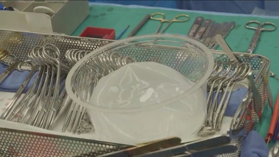 Chicago doctors use breast implants to perform double-lung transplant