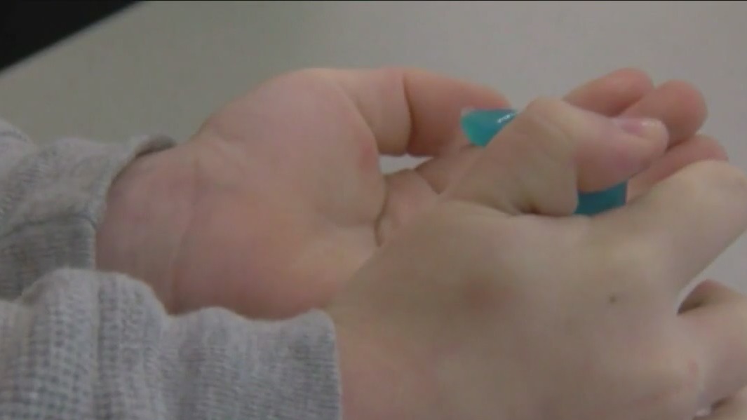 US health officials monitor mysterious respiratory illness