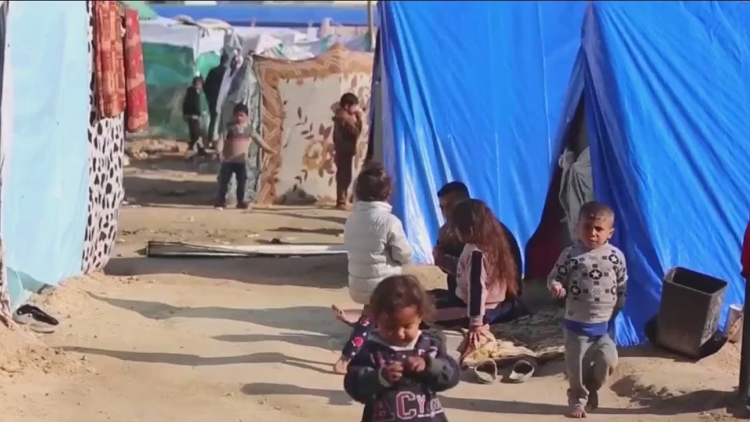 Malnutrition spreading across Gaza amid war