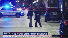 5-year-old boy in critical condition after being shot in the head