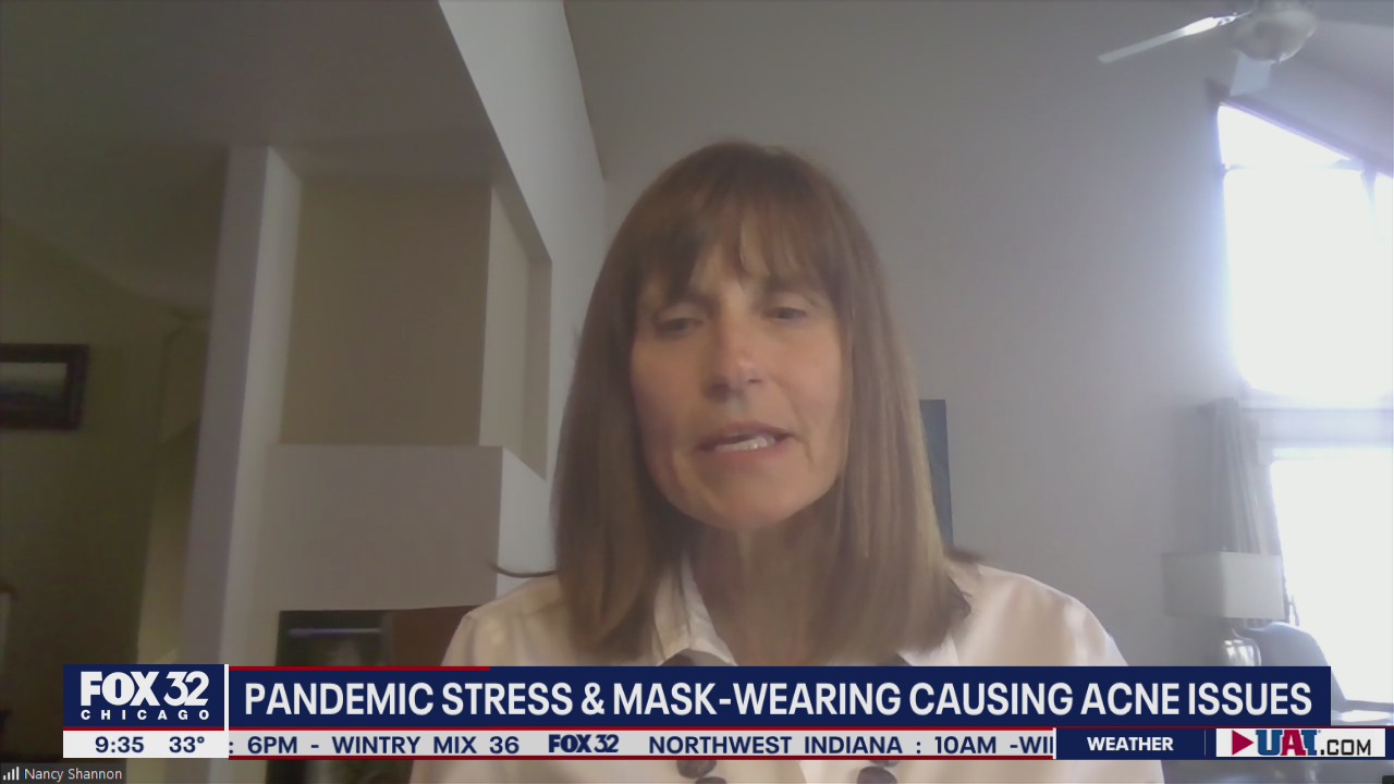 'Maskne': How to deal with mask-wearing acne issues