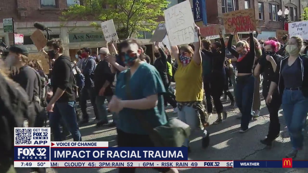 Impact of racial trauma goes further than skin deep