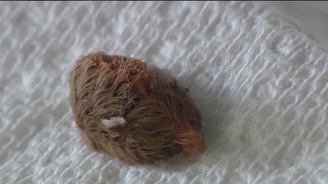 Puss caterpillar is back in Florida