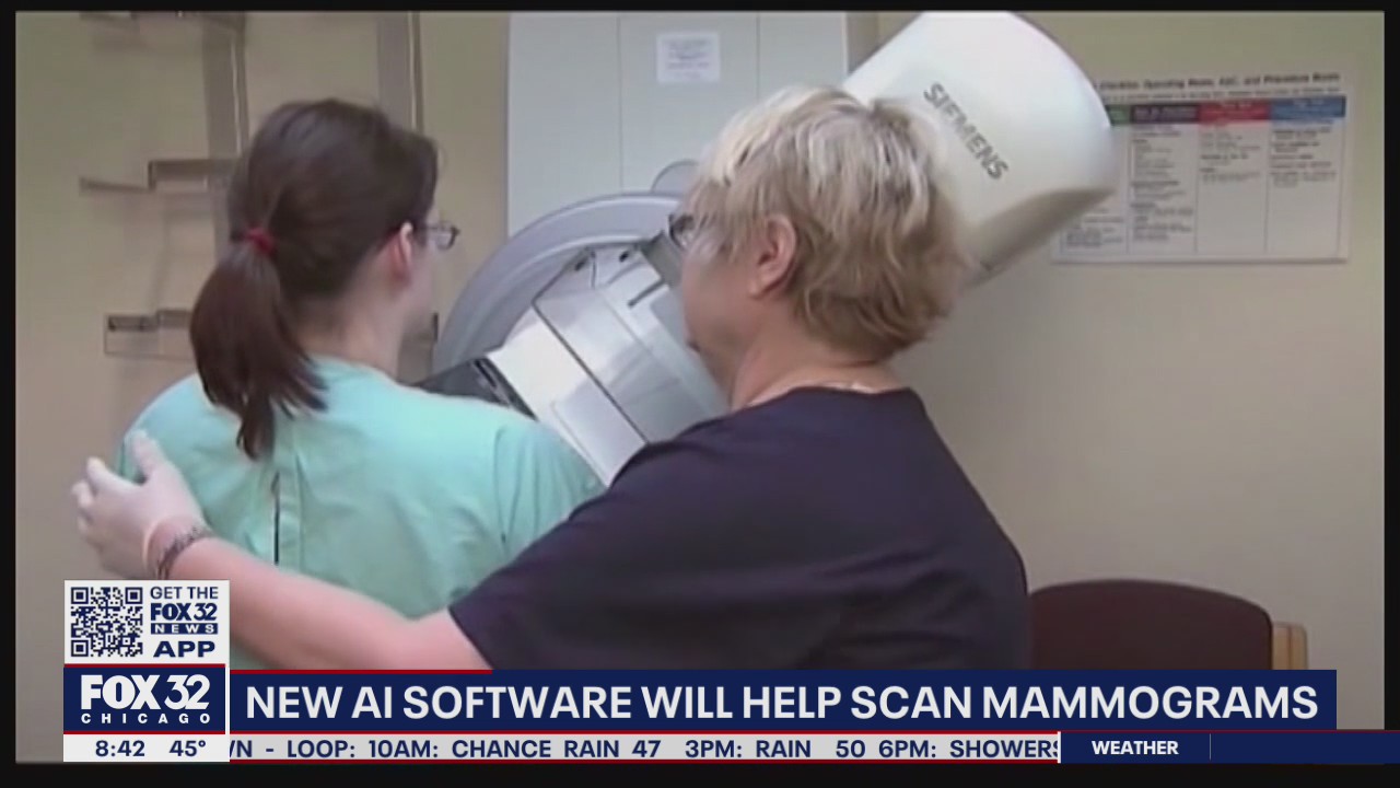 New AI software helps doctors scan mammograms for early signs of cancer