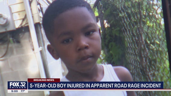 5-year-old boy struck by car during road rage incident in Chicago