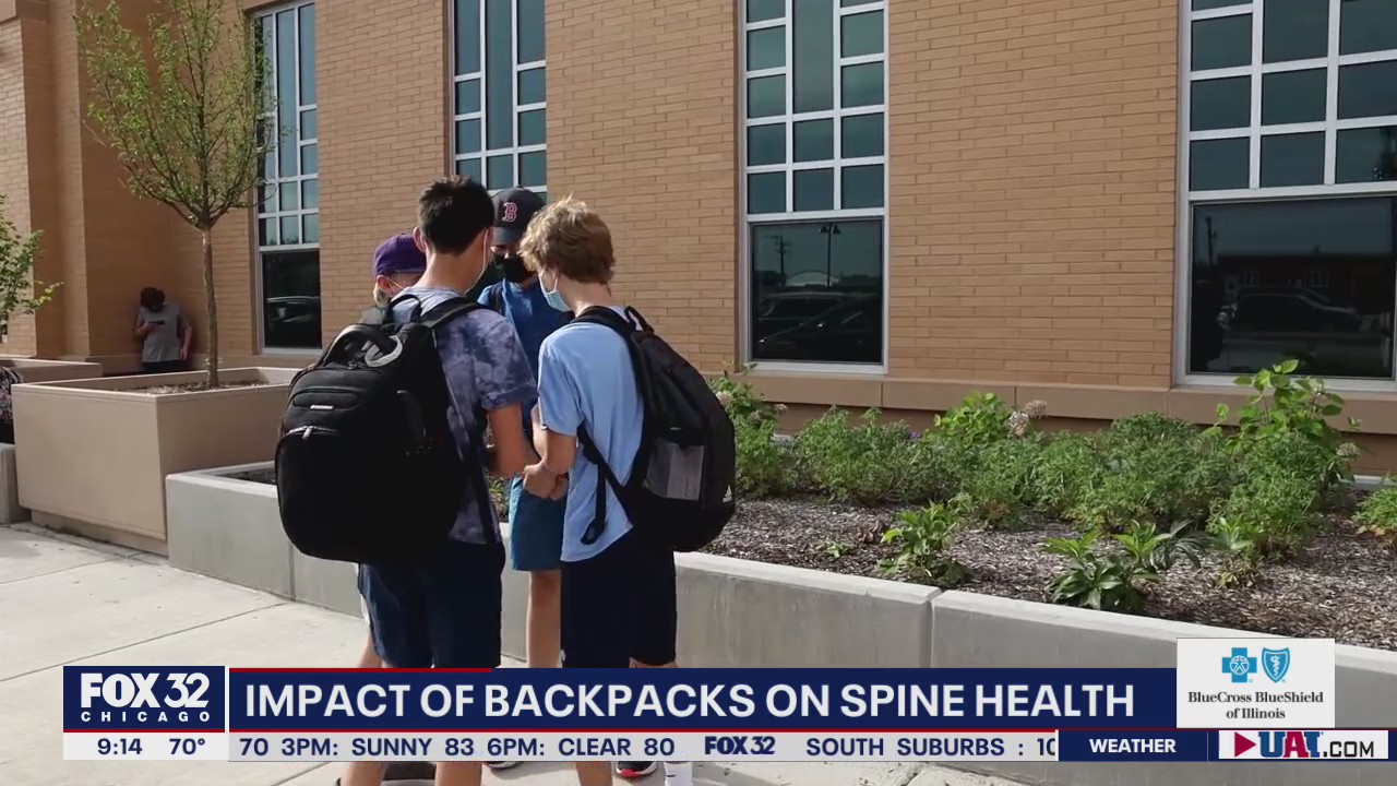 Overstuffed backpacks can be detrimental to spine health