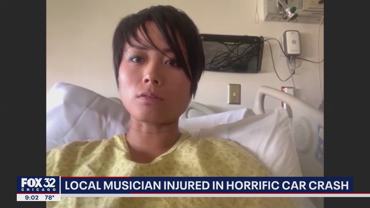 Chicago musician injured in horrific California car crash