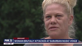 Woman, 41, brutally attacked at Frankfort music venue