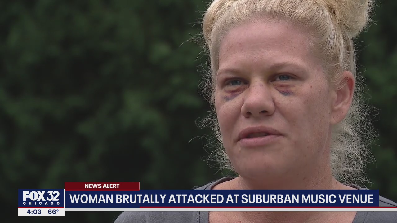 Woman, 41, brutally attacked at Frankfort music venue