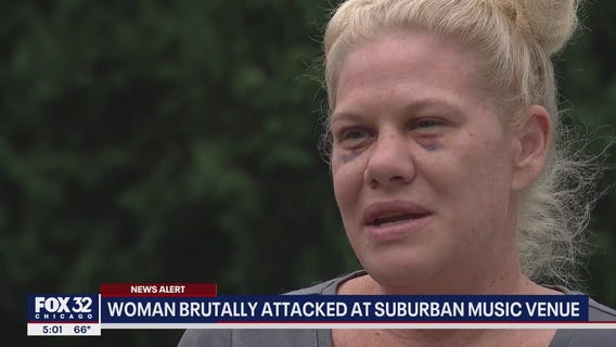 Woman brutally attacked at Frankfort music venue