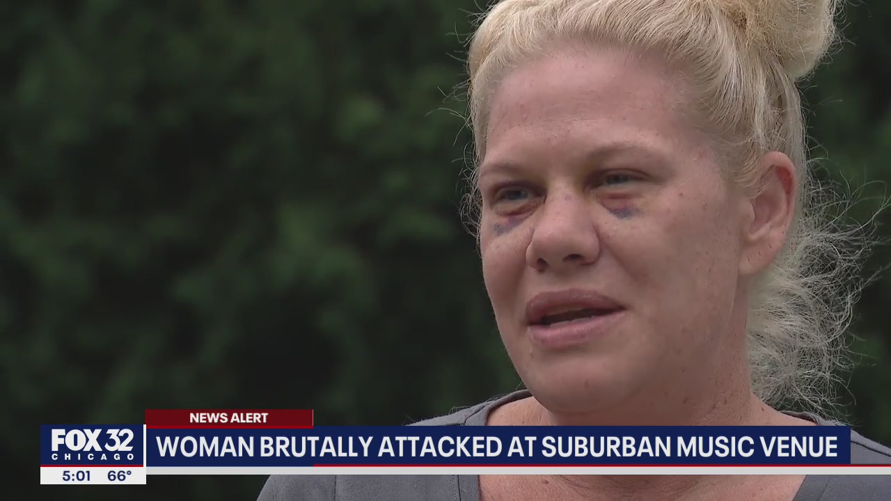 Woman brutally attacked at Frankfort music venue