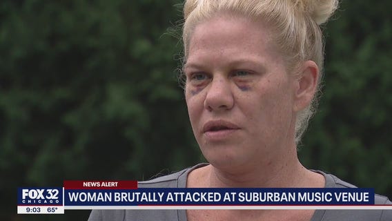 Woman, 41, brutally attacked at Frankfort music venue