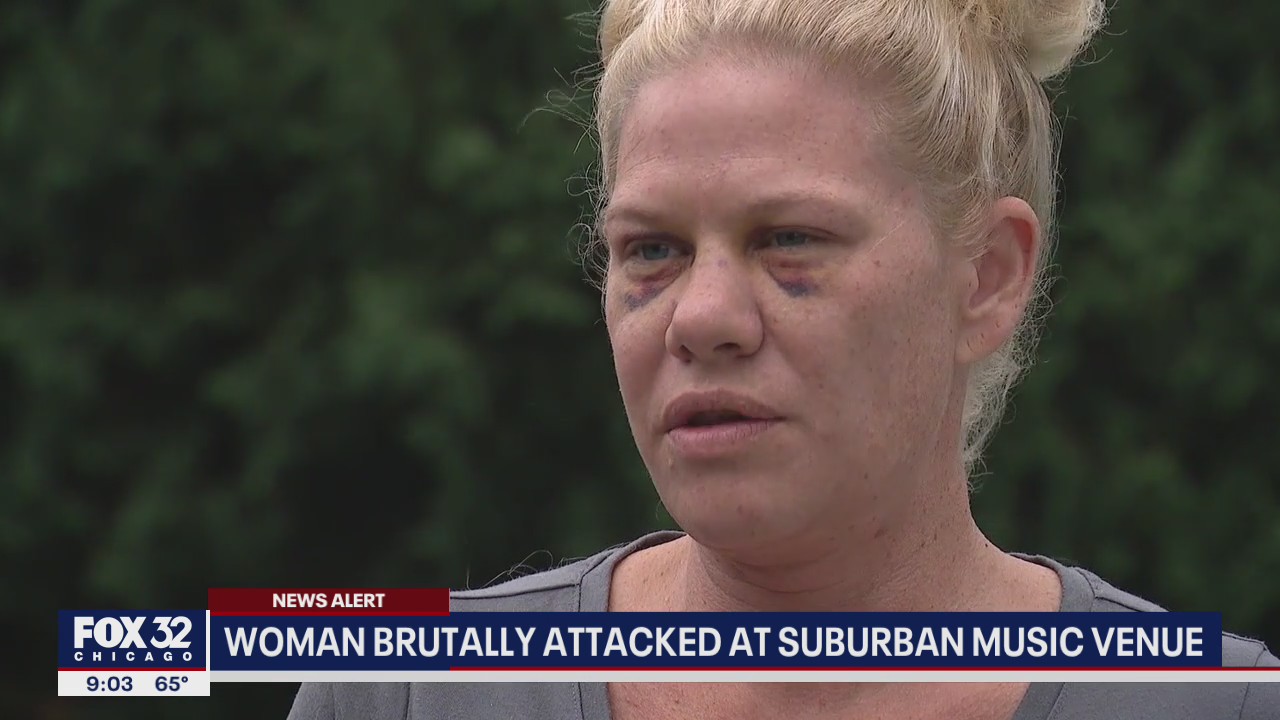 Woman, 41, brutally attacked at Frankfort music venue