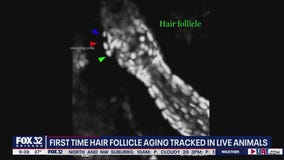 New Northwestern study on baldness provides new insight into root causes of hair loss