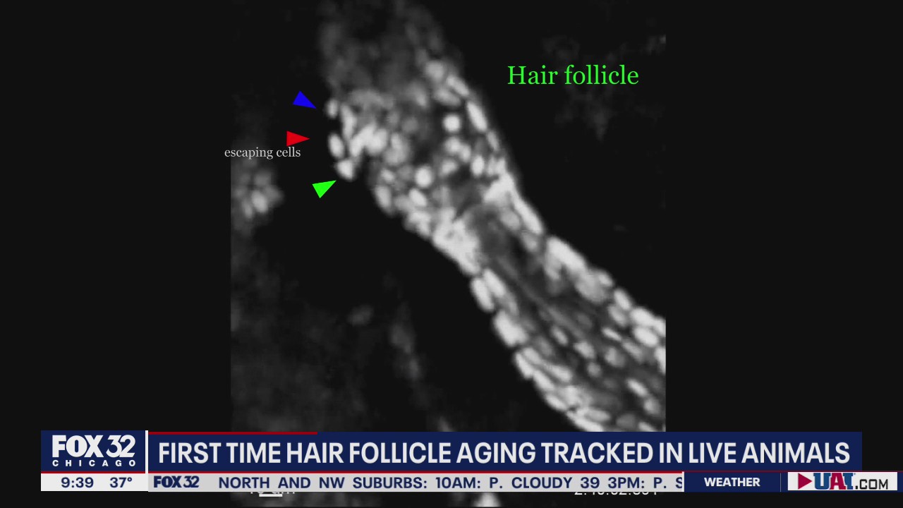 New Northwestern study on baldness provides new insight into root causes of hair loss