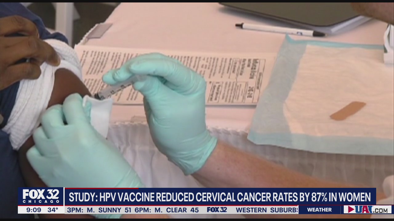 Study finds HPV vaccine drastically reduces cervical cancer rates in women