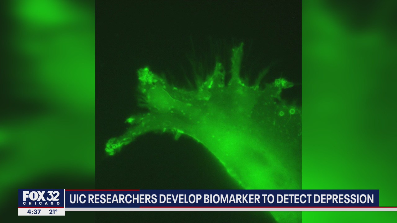 UIC researchers develop biomarker to detect depression