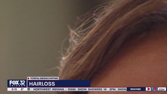 What are some of the different symptoms of the Omicron variant?