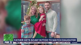 Crystal Lake father gets tattoo to match daughter's scar