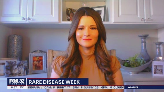 Plainfield mother raising awareness of rare epileptic disease impacting children