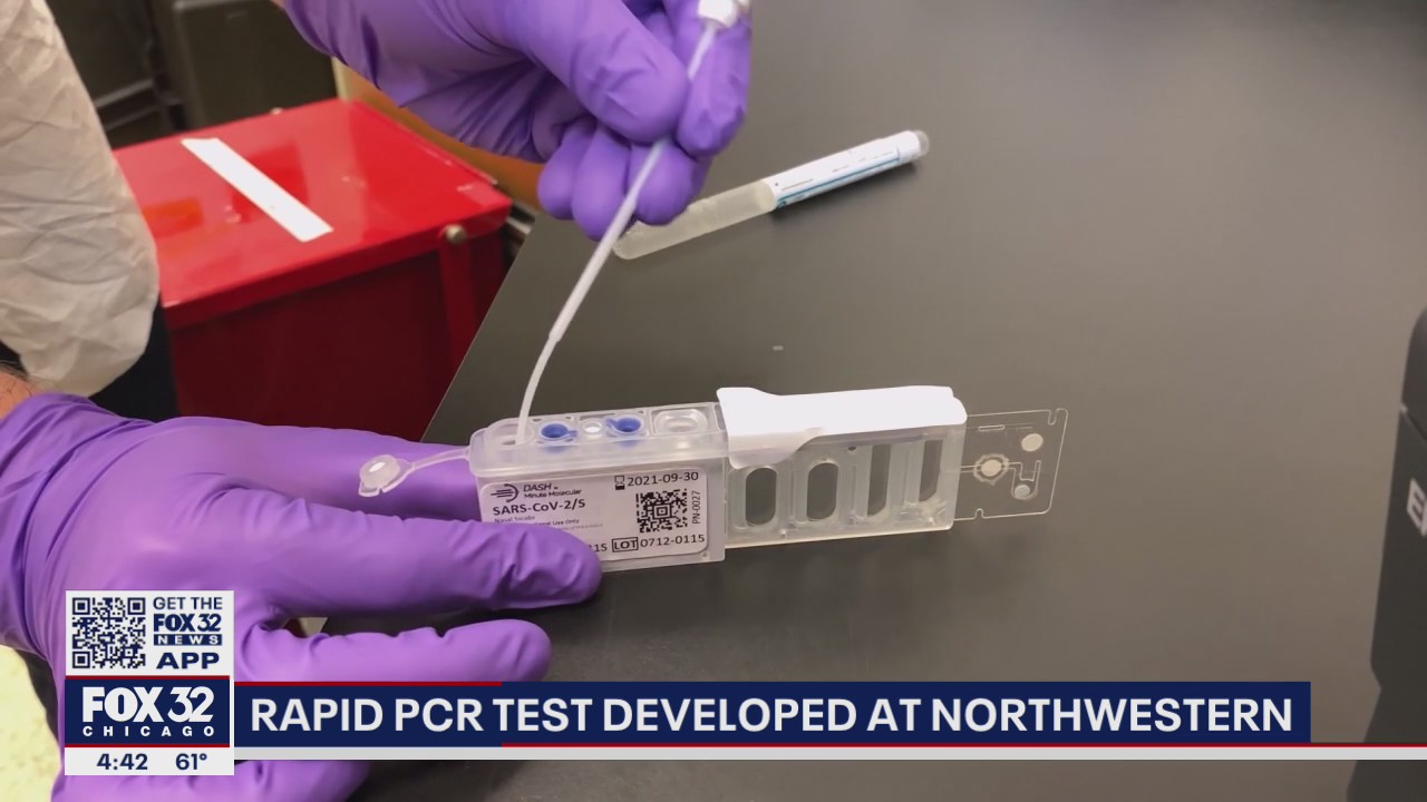 Rapid PCR Covid-19 test developed at Northwestern