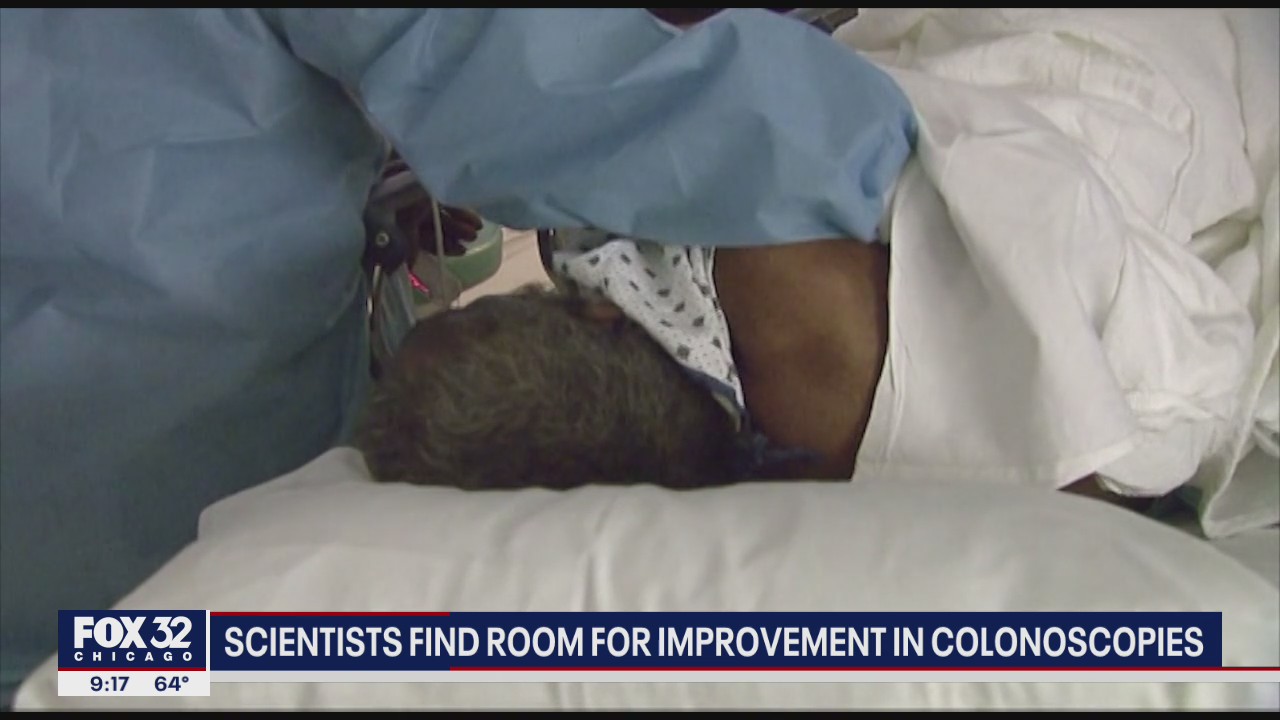 Scientists find room for improvement in colonoscopies
