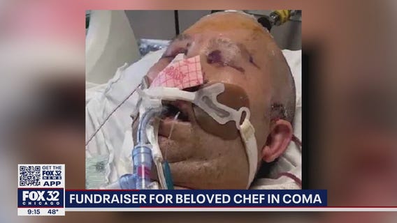 Chicago man 'left for dead' after carjacking near Dan Ryan