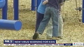 CDC issues alert after children contract severe cases of hepatitis