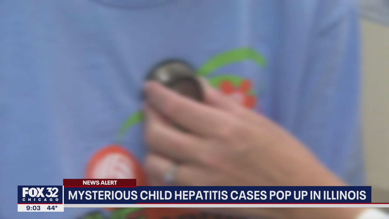 Illinois reports 3 possible cases of rare liver disease in children; 2 in Chicago area