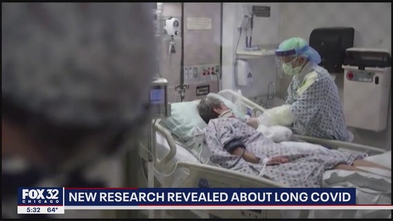 New research revealed about 'long Covid'