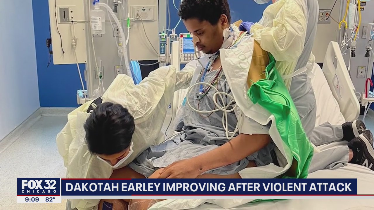 Dakotah Earley: Lincoln Park shooting victim improving after violent robbery