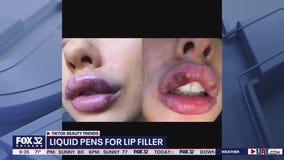 TikTok beauty trends raise concerns among medical community