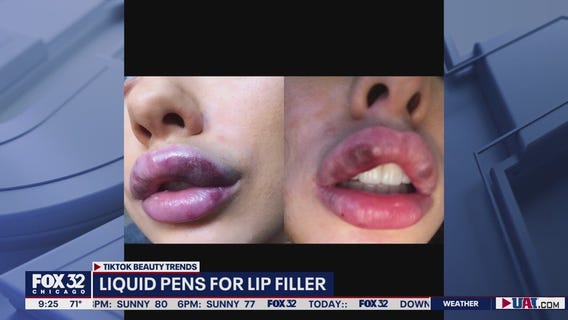 TikTok beauty trends raise concerns among medical community