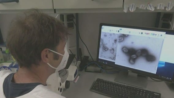 Illinois declares monkeypox a public health emergency