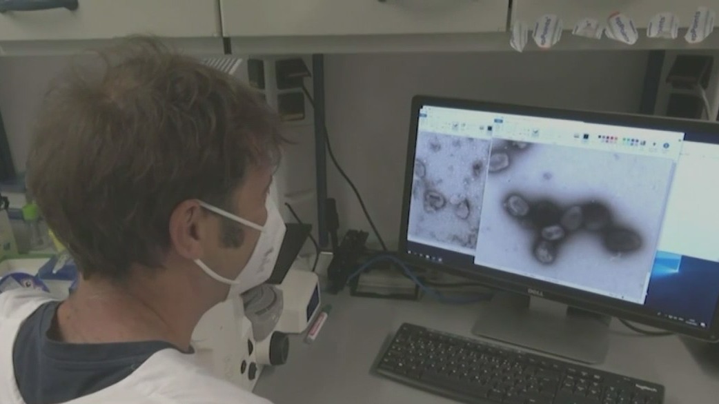 Illinois declares monkeypox a public health emergency